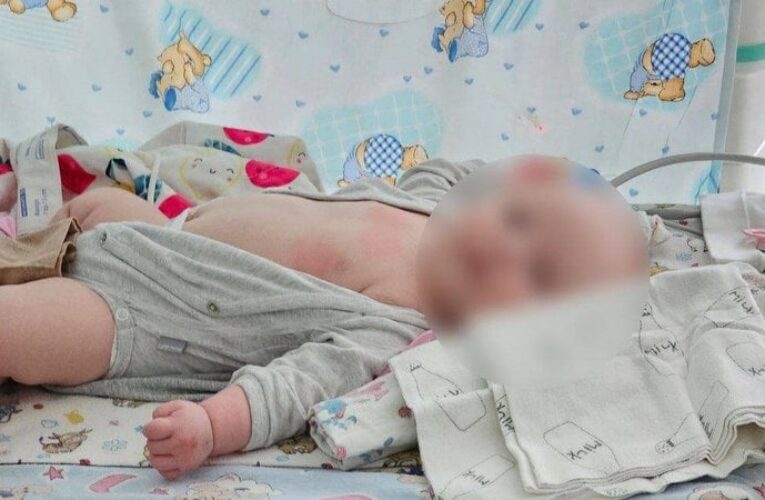 Обстріл авто з сім’єю під Херсоном: двомісячна дівчинка знаходиться в стані середньої тяжкості