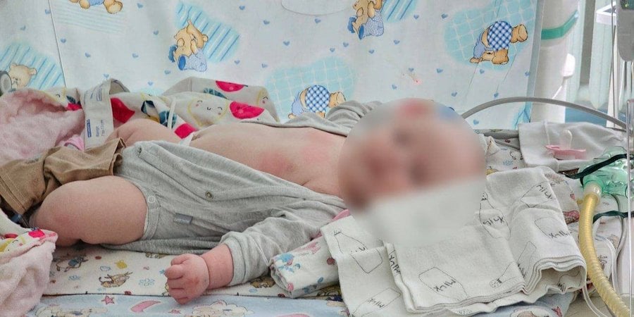 Двомісячна дівчинка, яка потрапила під російський обстріл (Фото:Олександр Прокудін/Telegram)